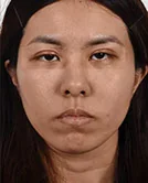 醫美整形影像 1