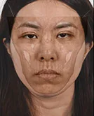 醫美整形影像 2