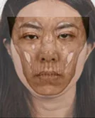 醫美整形影像 3