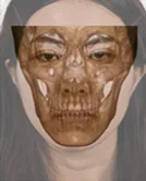 醫美整形影像 4