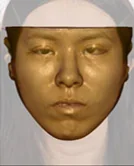 醫美整形影像 6