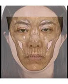 醫美整形動畫影片 3