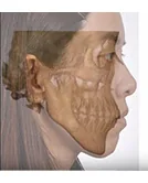 醫美整形動畫影片 4