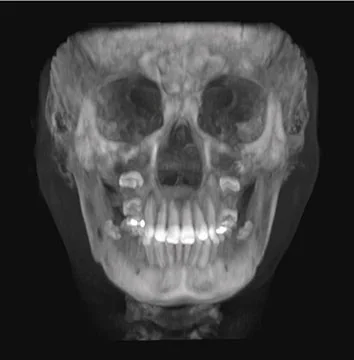 3D立體影像 1